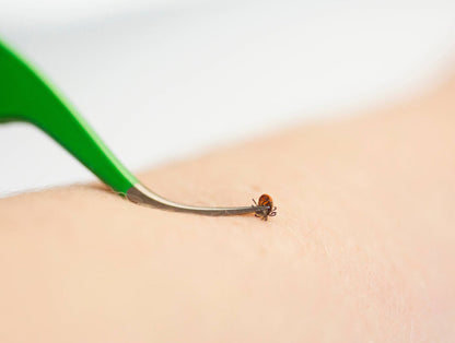 TickCheck Premium Tick Remover Kit